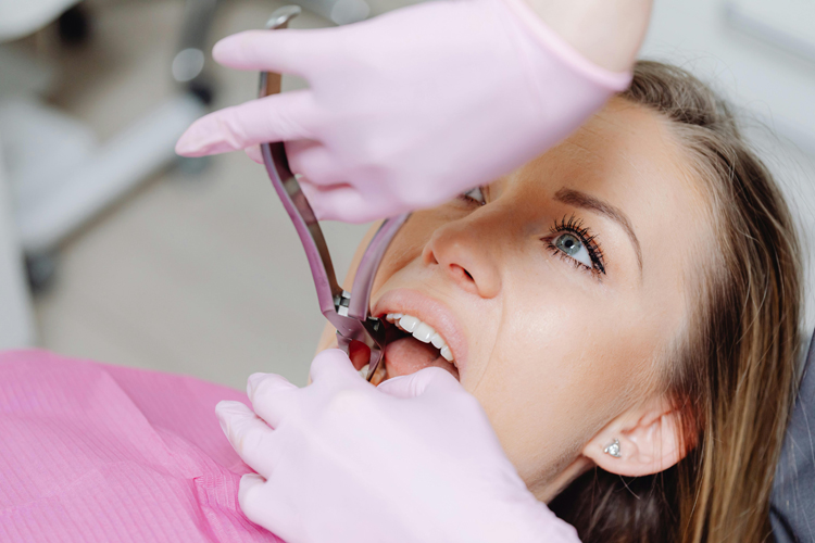Dental Extractions Elfar Dental Belconnen Canberra