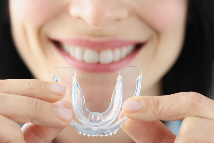 Dental Mouth Guards Elfar Dental Belconnen