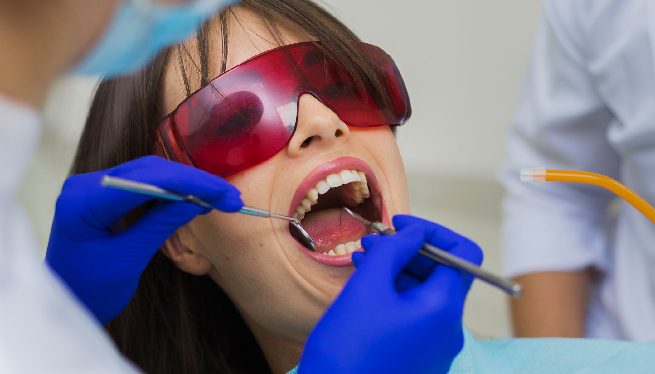 Dental Fillings Elfar Dental Belconnen