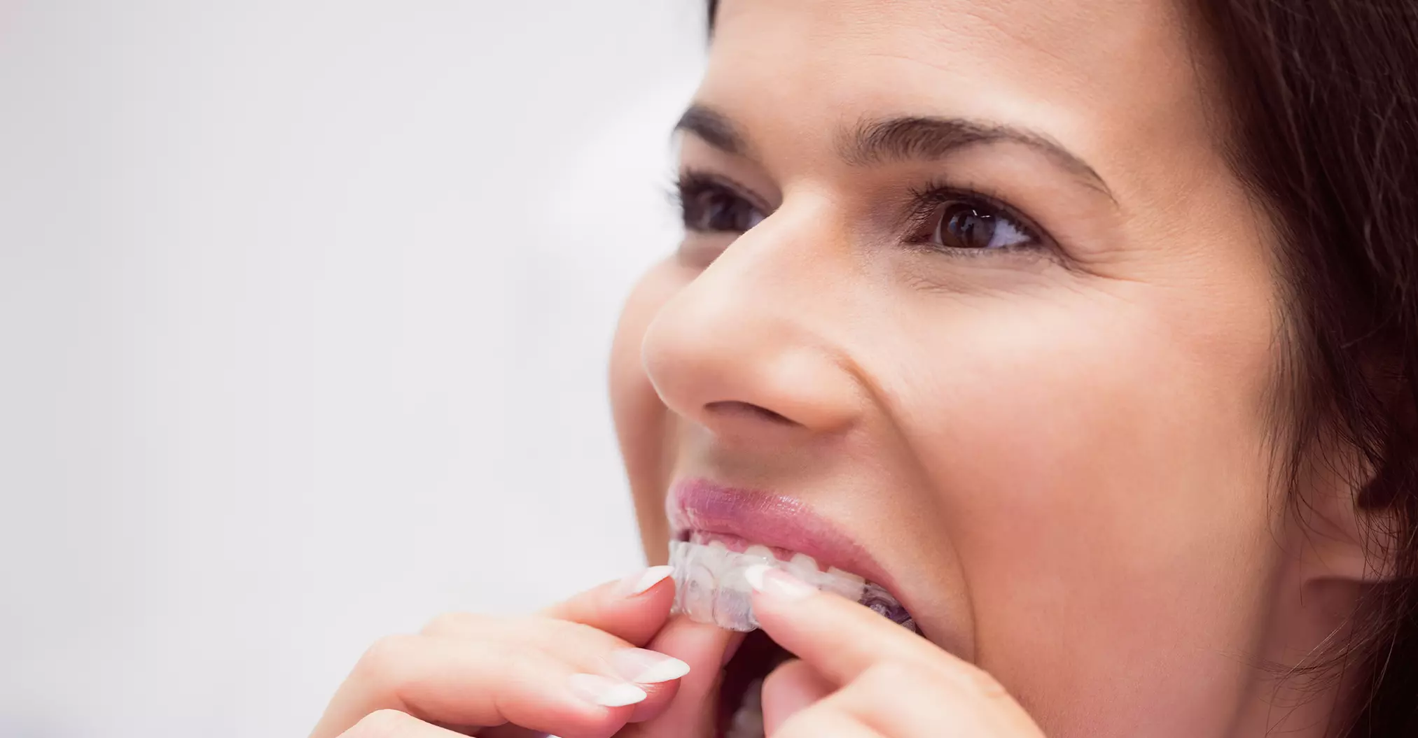 Dental Mouth Guards Elfar Dental Belconnen