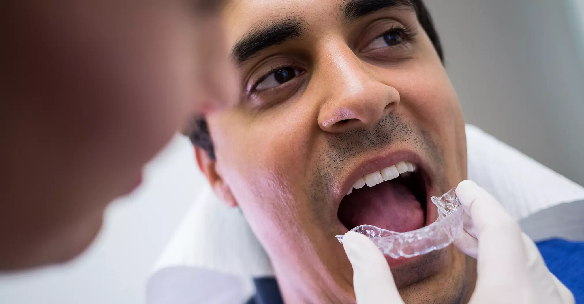 Dental Mouth Guards Elfar Dental Belconnen