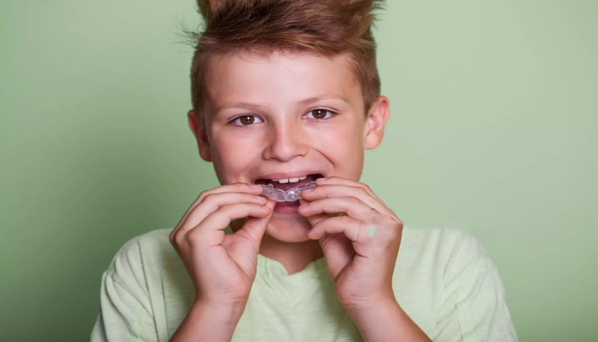 Dental Mouth Guards Elfar Dental Belconnen