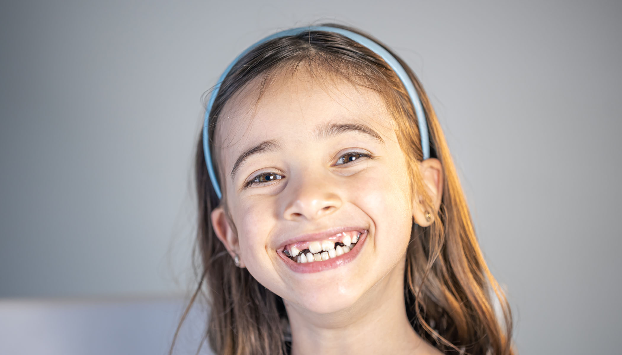 Knocked Out Teeth Elfar Dental Belconnen