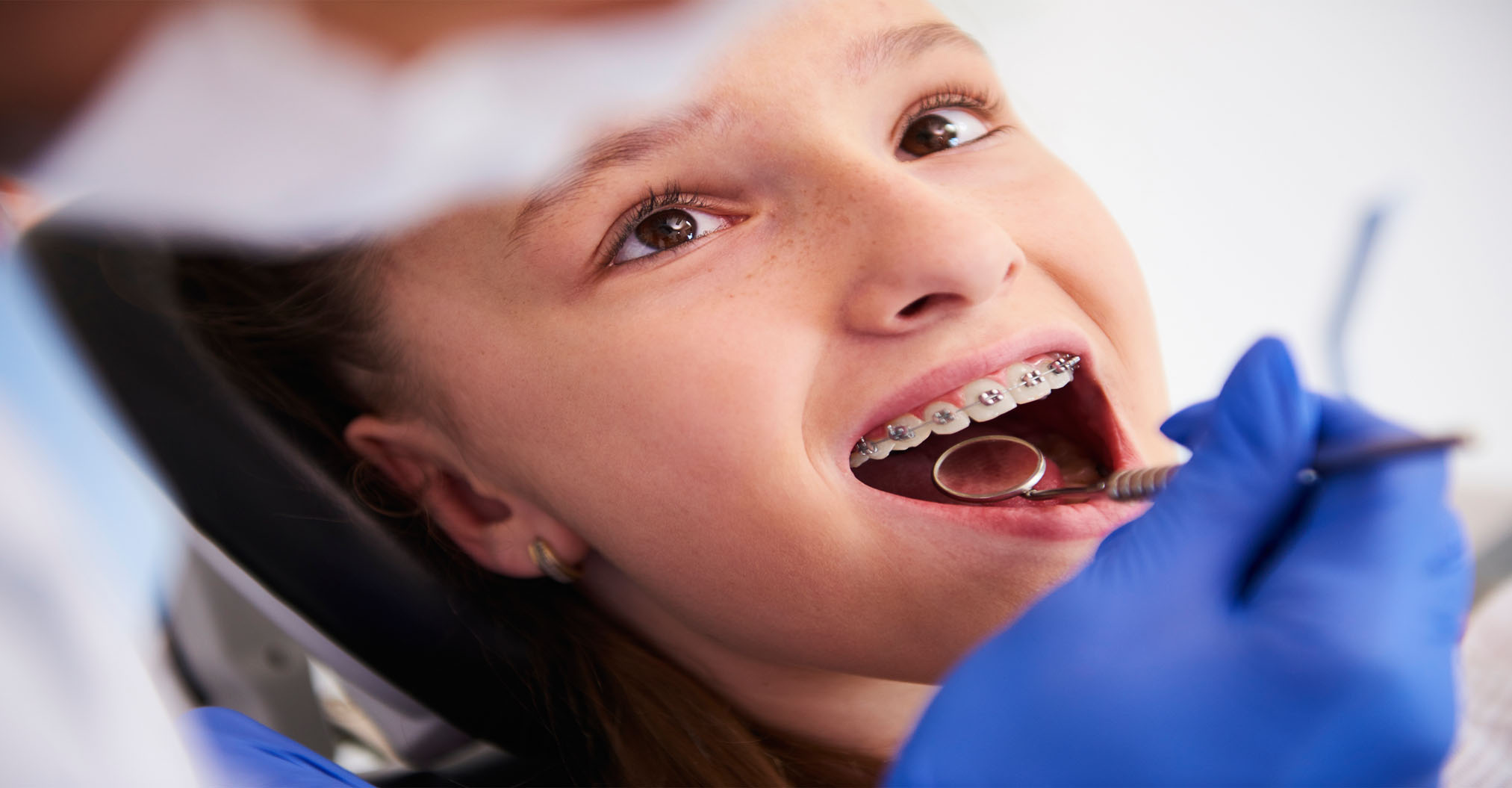 Pediatric Dentistry Elfar Dental Belconnen