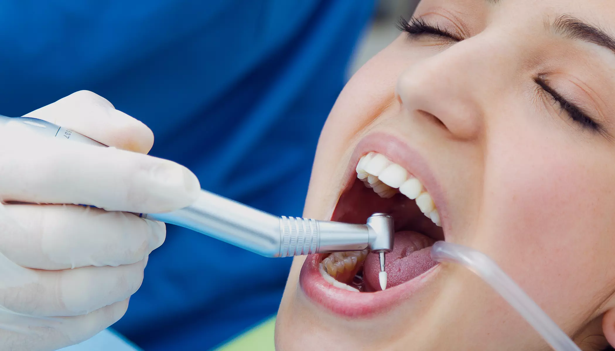 Root Canal Treatment Elfar Dental Belconnen