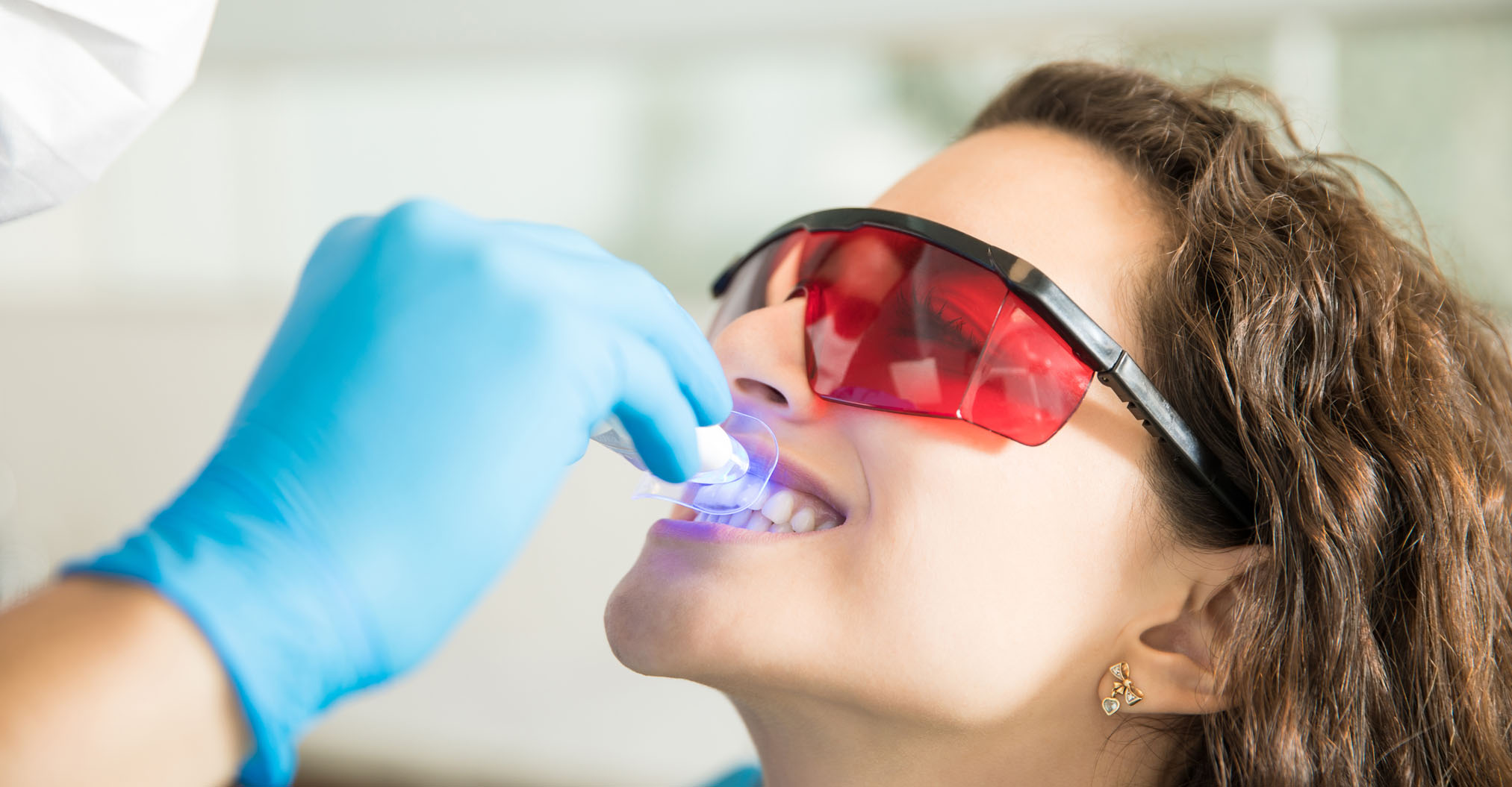 Teeth Whitening Elfar Dental Belconnen