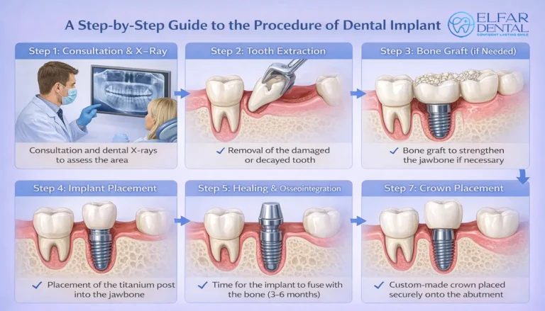 Benefits Of Dental Implants Cost Procedure Elfar Dental Belconnen Canberra ACT