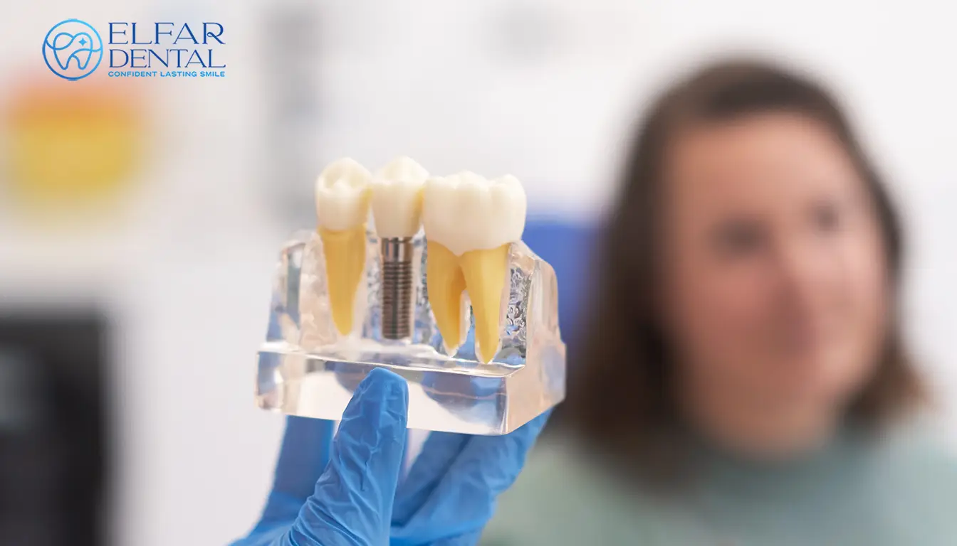 Benefits Of Dental Implants Cost Procedure Elfar Dental Belconnen Canberra ACT
