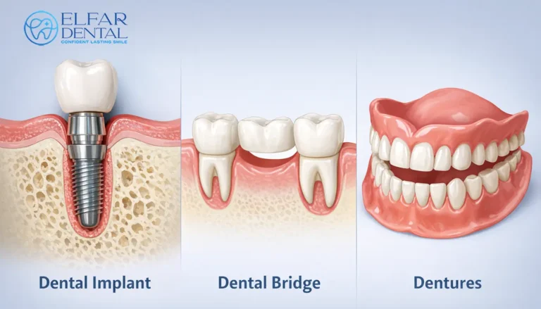Benefits Of Dental Implants Cost Procedure Elfar Dental Belconnen Canberra ACT