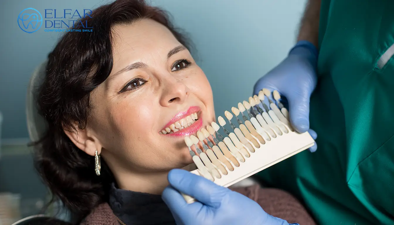 Natural Looking Veneers Smile Makeover Cosmetic Dentistry Elfar Dental Belconnen Canberra ACT