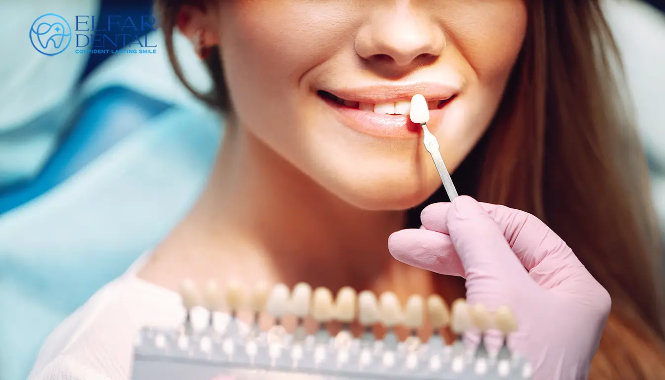 Natural Looking Veneers Smile Makeover Cosmetic Dentistry Elfar Dental Belconnen Canberra ACT