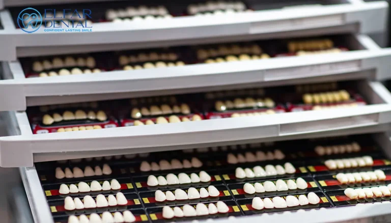 Natural Looking Veneers Smile Makeover Cosmetic Dentistry Elfar Dental Belconnen Canberra ACT