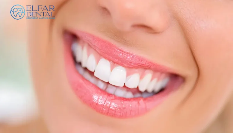 Teeth Whitening Dental Bonding Invisalign Smile Makeover Cosmetic Dentistry Dental Treatments Elfar Dental Belconnen Canberra ACT