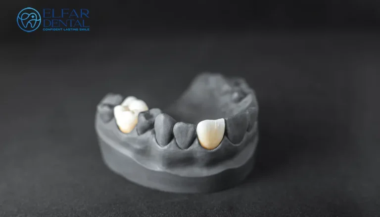 New Dental Crown Feels High Dental Crown Adjustment Dental Restorations Elfar Dental Belconnen Canberra ACT