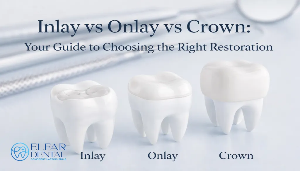 Inlay vs Onlay vs Crown Tooth Filling vs Crown Tooth Restoration Dentist Elfar Dental Belconnen Canberra ACT