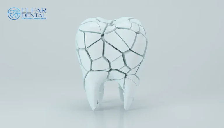 Cracked Tooth Syndrome Causes Symptoms Treatment Elfar Dental Belconnen Dentist Canberra