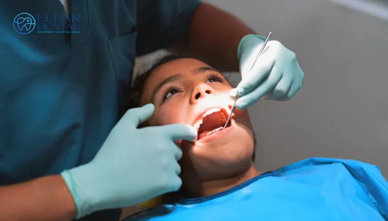 Cracked Tooth Syndrome Causes Symptoms Treatment Elfar Dental Belconnen Dentist Canberra
