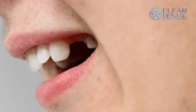 Tooth Replacement Options Dental Implants Dental Bridges Dentures Elfar Dental Belconnen Dentist Canberra