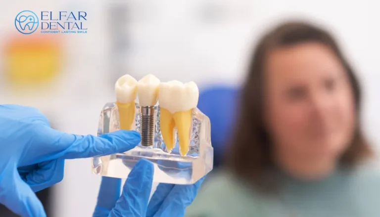 Tooth Replacement Options Dental Implants Dental Bridges Dentures Elfar Dental Belconnen Dentist Canberra