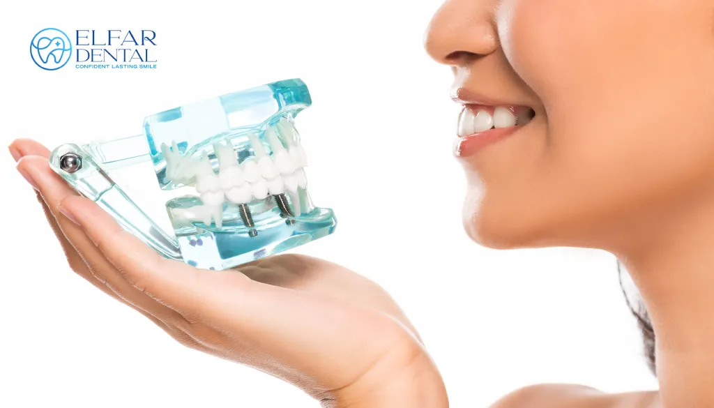 Dental Implants Belconnen Implant Dentist Elfar Dental Belconnen Dentist Canberra ACT