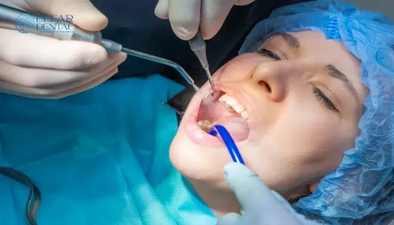 Wisdom Teeth Removal Belconnen Elfar Dental Belconnen Dentists Canberra ACT