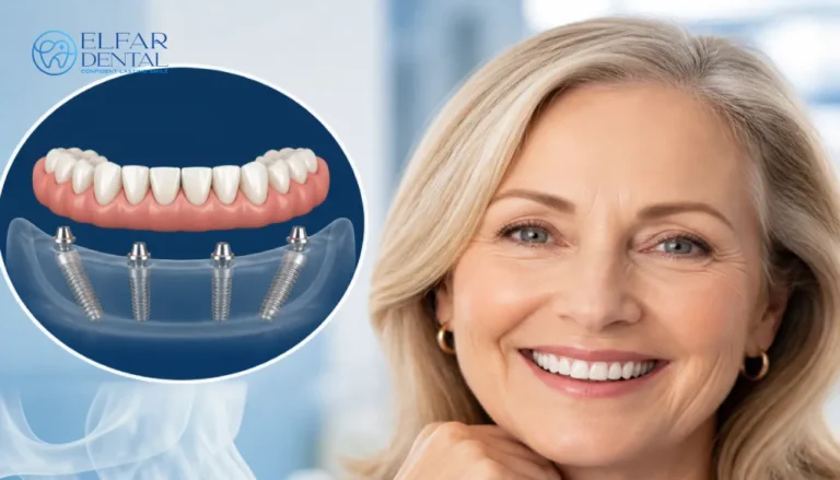 Benefits of All-on-4 Implants - Elfar Dental Belconnen Dentists Canberra ACT