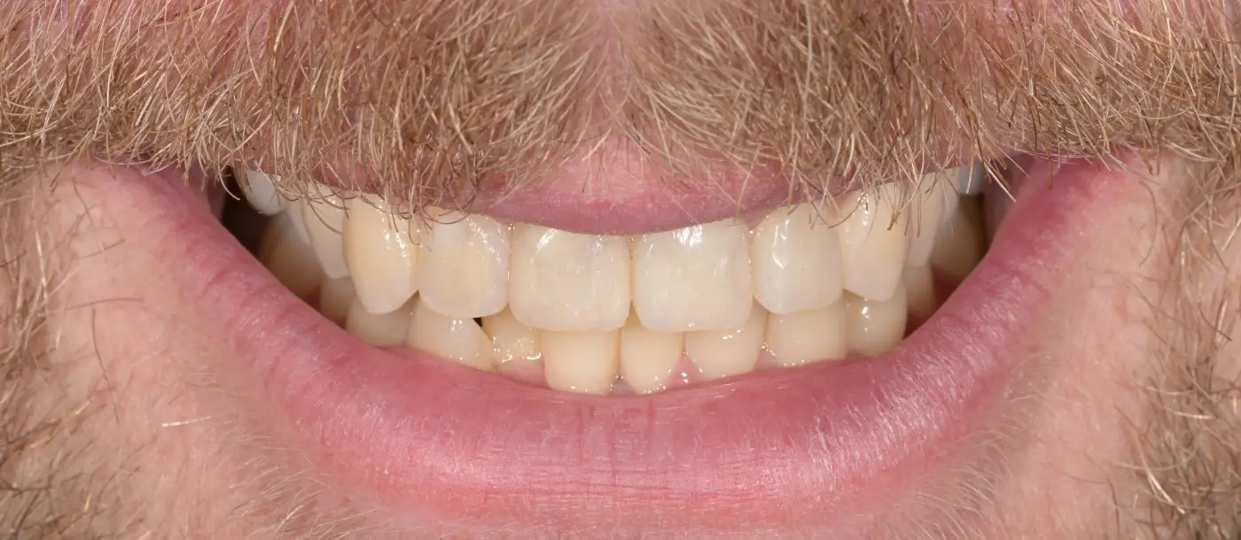 After