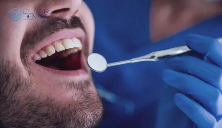 Dentist for Bleeding Gums Canberra Elfar Dental Clinic Belconnen Dentists Canberra ACT 15 Dentist Belconnen–General & Cosmetic Dentistry Elfar Dental