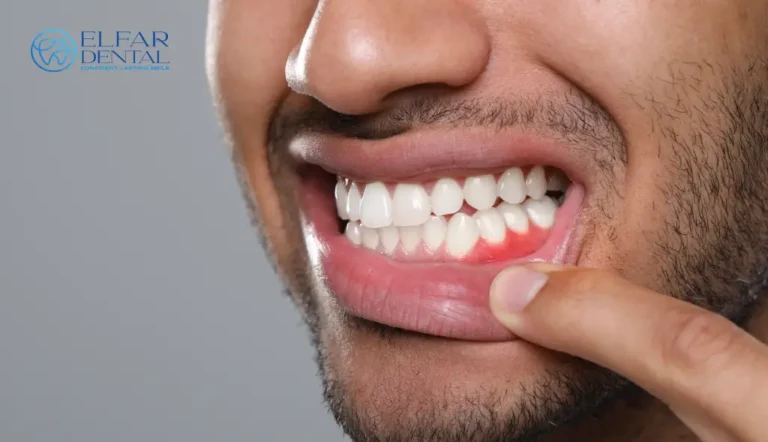 The Sensitive Tooth Survival Guide - Elfar Dental Belconnen Dentists Canberra ACT