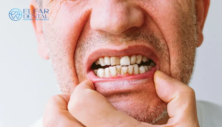 The Sensitive Tooth Survival Guide Elfar Dental Belconnen Dentists Canberra ACT 6 Dentist Belconnen–General & Cosmetic Dentistry Elfar Dental