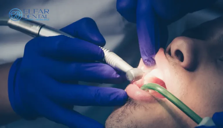 Dental Cleaning vs Dental Check-Up Canberra - Elfar Dental Clinic Belconnen Dentist Canberra ACT