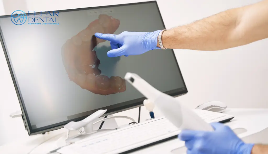 Guide to Dental Check Ups Elfar Dental Clinic Belconnen Dentists Canberra ACT 6 Dentist Belconnen–General & Cosmetic Dentistry Elfar Dental