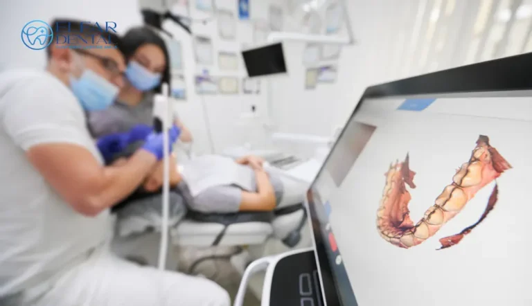 Guide to Dental Check Ups Elfar Dental Clinic Belconnen Dentists Canberra ACT 7 Dentist Belconnen–General & Cosmetic Dentistry Elfar Dental