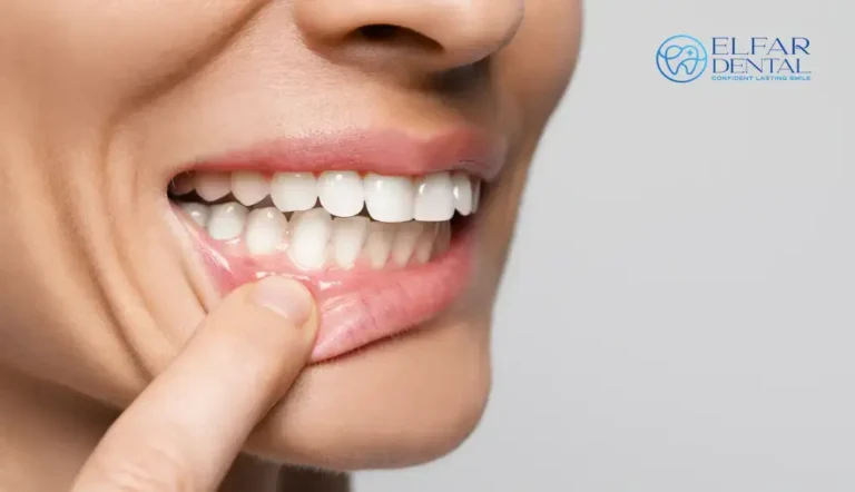 Why Do My Gums Bleed When I Floss Elfar Dental Clinic Belconnen Dentist Canberra ACT Dentist Belconnen–General & Cosmetic Dentistry Elfar Dental