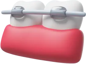Elfar Dental Dentist Belconnen Canberra